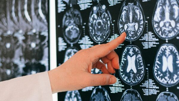A person pointing to brain scan images.